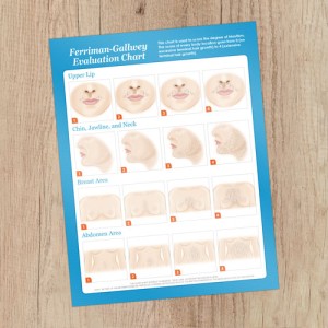 Hirsutism Chart  8.5x11 Consultation Card - Rated R